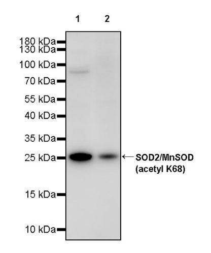 SOD2/MnSOD (acetyl K68) Rabbit Polyclonal Antibody