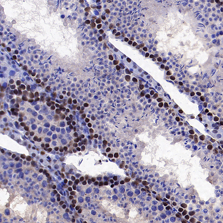 PCNA Recombinant Mouse mAb (S-5477)