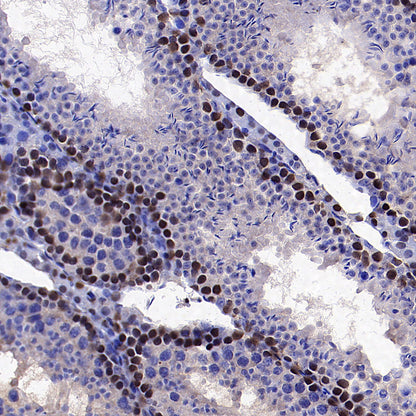 PCNA Recombinant Mouse mAb (S-5477)