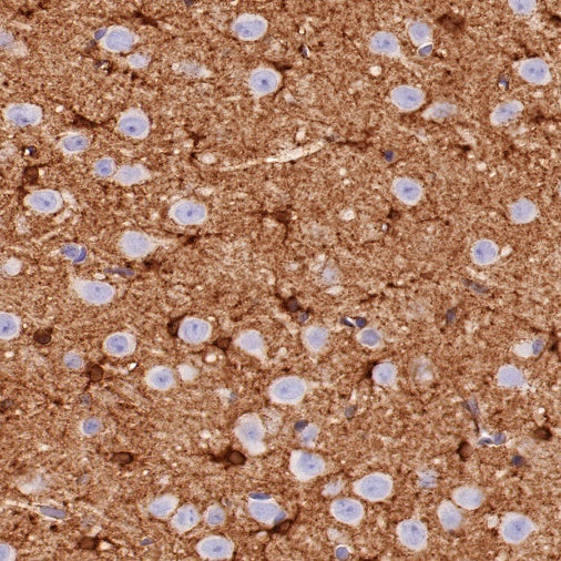 Glutamine Synthetase (GS) Recombinant Rabbit mAb (SDT-549-25)