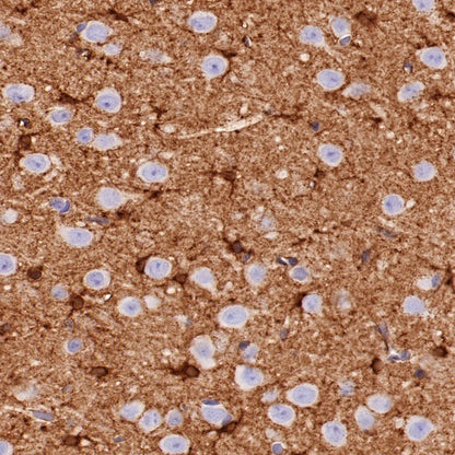 Glutamine Synthetase (GS) Recombinant Rabbit mAb (SDT-549-25)