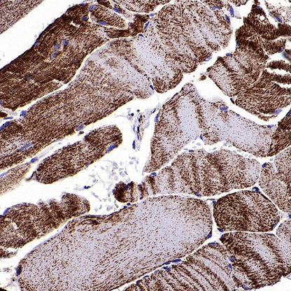 Fumarate hydratase Recombinant Rabbit mAb (SDT-2394-36)