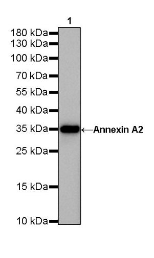S-RMab®Annexin A2 Recombinant Rabbit mAb (SDT-444-67)