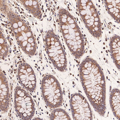 TUBA1B Rabbit Polyclonal Antibody