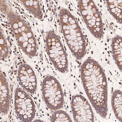 TUBA1B Rabbit Polyclonal Antibody