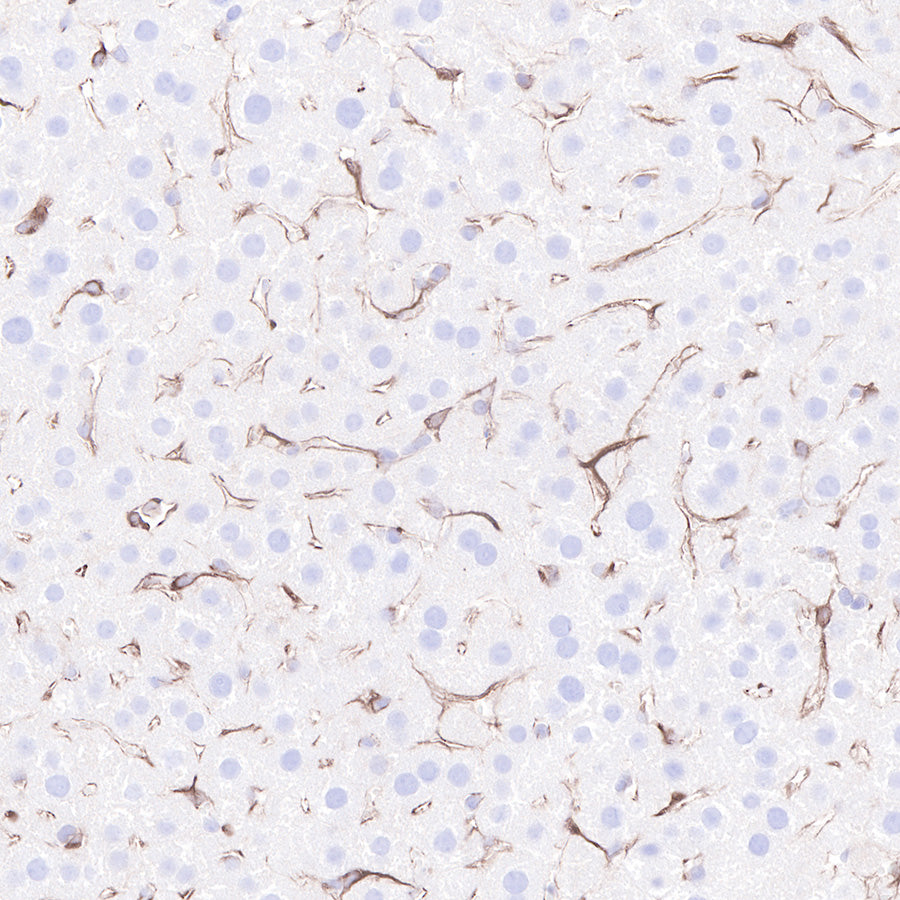 Beta 2 microglobulin Recombinant rabbit mAb (SDT-096-100)