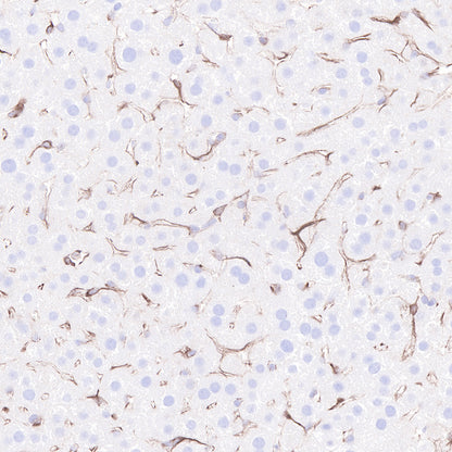 Beta 2 microglobulin Recombinant rabbit mAb (SDT-096-100)