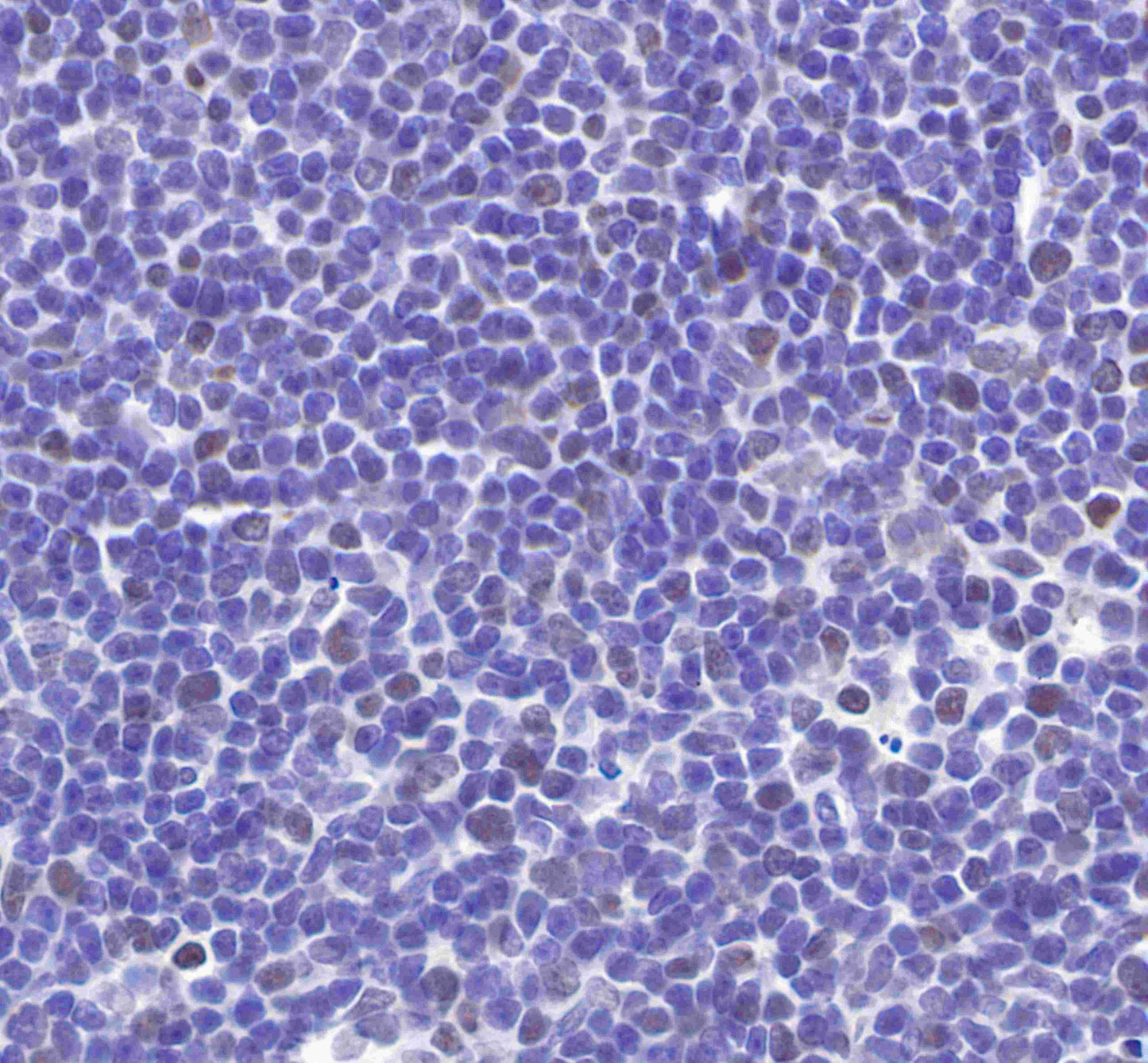 S-RMab® MCM2 Recombinant Rabbit mAb (SDT-018-68)