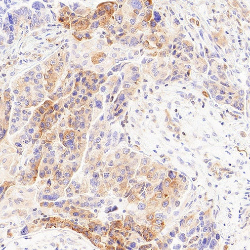 LPCAT1 Recombinant Rabbit mAb (S-6053)