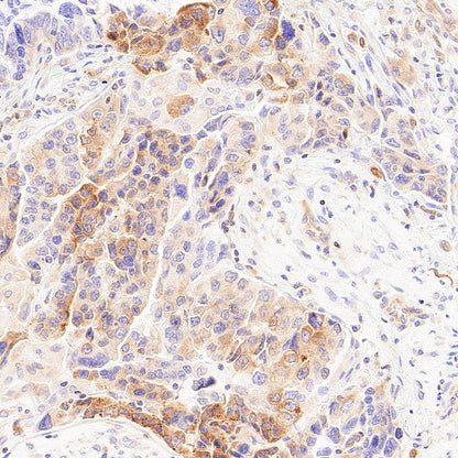 LPCAT1 Recombinant Rabbit mAb (S-6053)