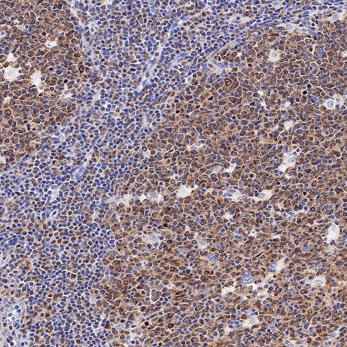 MCL1 Recombinant Rabbit mAb (S-772-109)