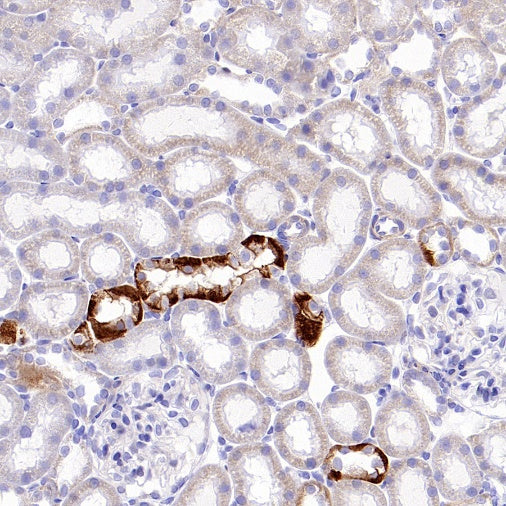 SLC8A1 Recombinant Rabbit mAb (S-3100-17)
