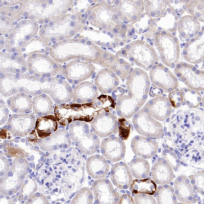 SLC8A1 Recombinant Rabbit mAb (S-3100-17)