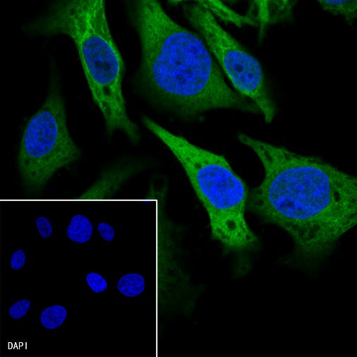 Calpastatin Recombinant Rabbit mAb (S-R184)