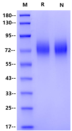TrkB His Tag Protein, Human