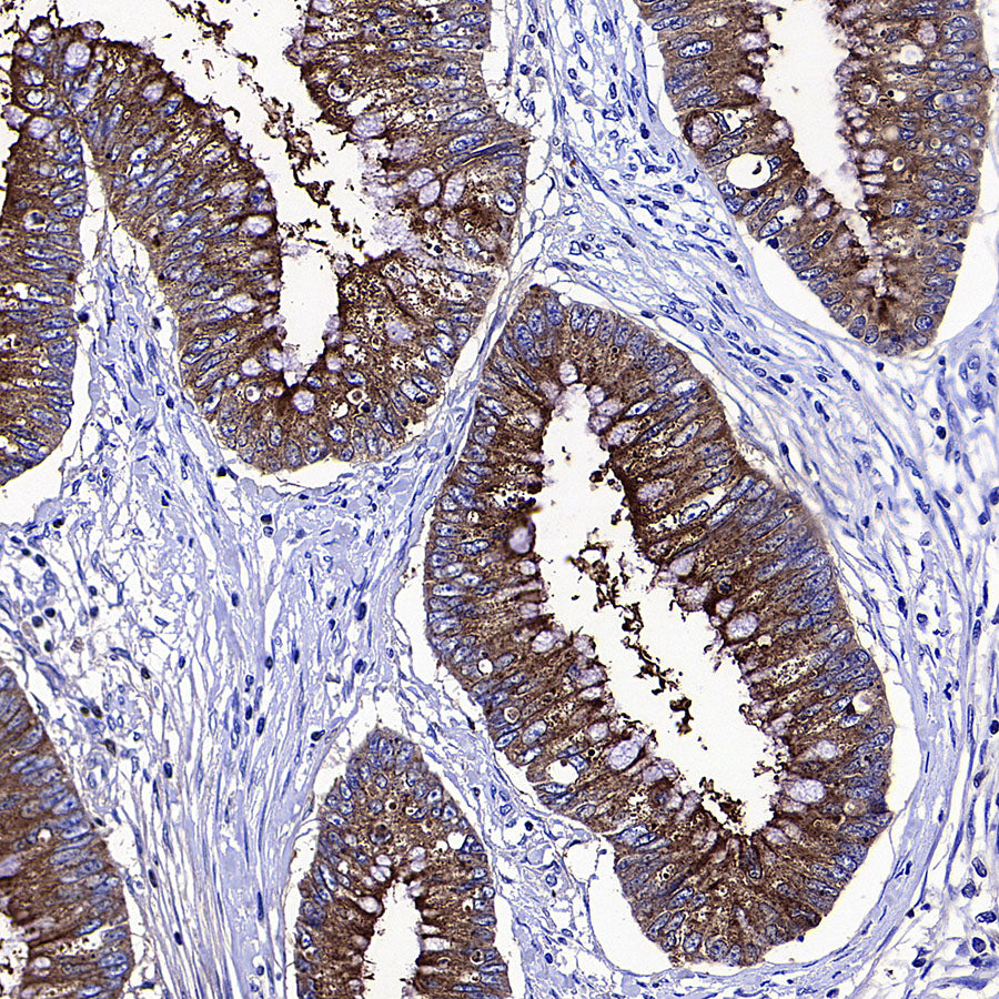 CEA Recombinant Rabbit mAb (SDT-098-41)