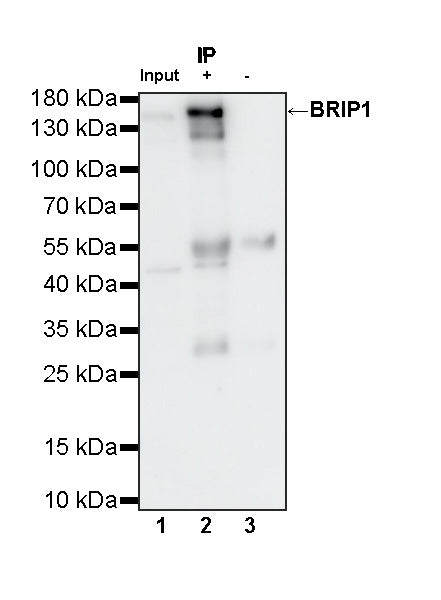BRIP1 Recombinant Rabbit mAb (S-4535-79)