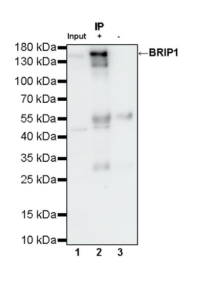 BRIP1 Recombinant Rabbit mAb (S-4535-79)