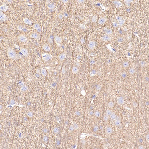 Beta II tubulin Recombinant Rabbit mAb (S-1055-2)