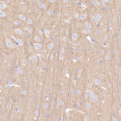 Beta II tubulin Recombinant Rabbit mAb (S-1055-2)