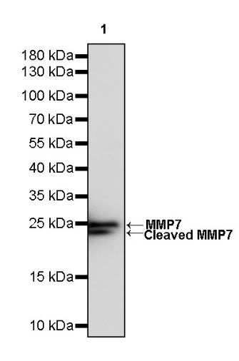 MMP7 Recombinant Rabbit mAb (S-1628-25)