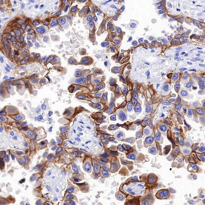 TACSTD2/TROP2 Recombinant Rabbit mAb (S-R238)