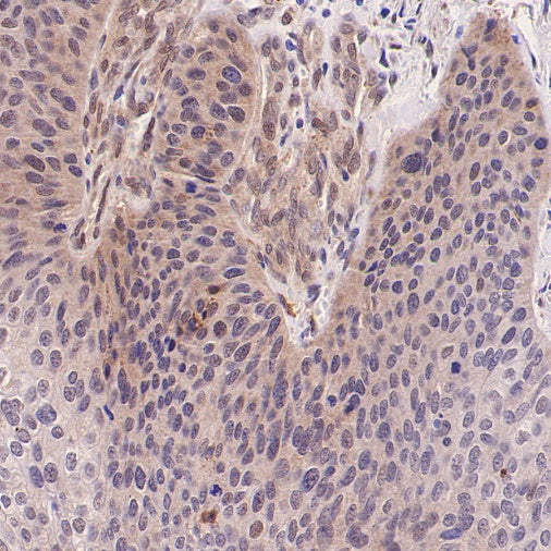 Cleaved Caspase-3 (Asp175) Recombinant Rabbit mAb (S-1406-409)