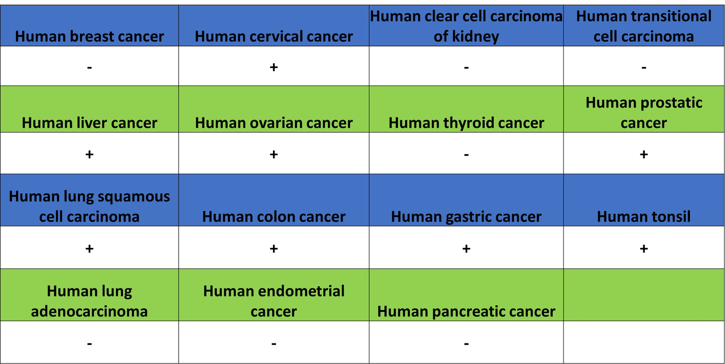 MCT1/Monocarboxylic acid transporter 1 Recombinant Rabbit mAb (S-5144)