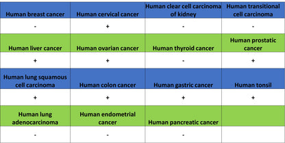 MCT1/Monocarboxylic acid transporter 1 Recombinant Rabbit mAb (S-5144)
