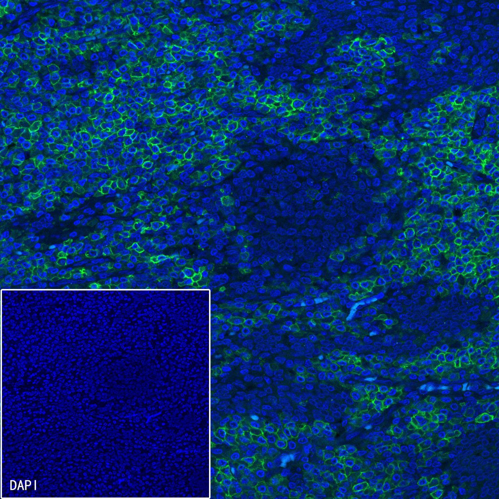 CD5 Mouse mAb (Alexa Fluor® 488 Conjugate) (S-576-35)