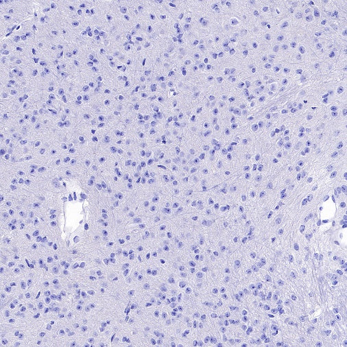 Lipocalin-2/NGAL Recombinant Rabbit mAb (S-2280-129)