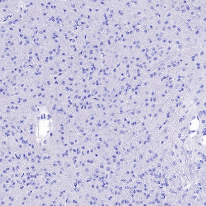 Lipocalin-2/NGAL Recombinant Rabbit mAb (S-2280-129)