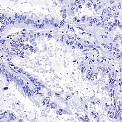 SEZ6 Recombinant Rabbit mAb (SDT-2097-737)