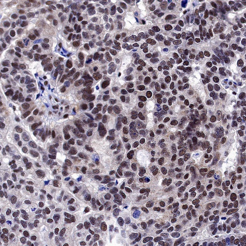 Estrogen Receptor β Recombinant Rabbit mAb (S-1396-67）