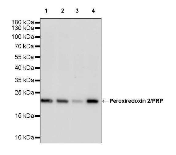 Peroxiredoxin 2/PRP Recombinant Rabbit mAb (S-1523-30)