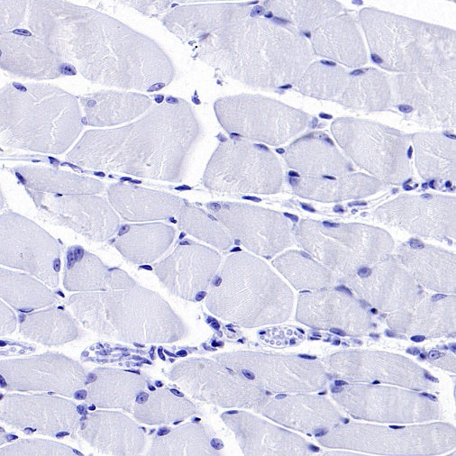 TROP1/EPCAM Recombinant Rabbit mAb (S-1379-5)
