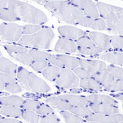 TROP1/EPCAM Recombinant Rabbit mAb (S-1379-5)