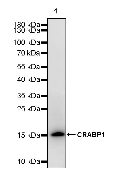 CRABP1 Recombinant Rabbit mAb (S-4212-76)