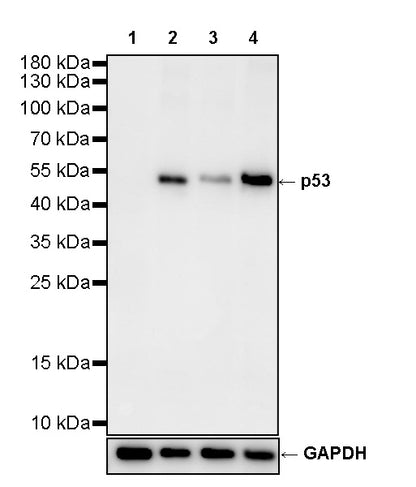 S-RMab® p53 Recombinant Rabbit mAb (SDT-R118)