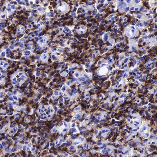 Lck Recombinant Rabbit mAb (SDT-316-15)