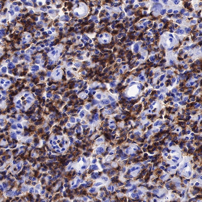 Lck Recombinant Rabbit mAb (SDT-316-15)