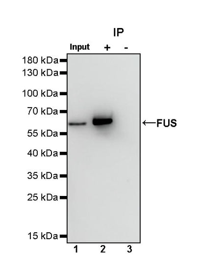 FUS Recombinant Rabbit mAb (S-1015-21)