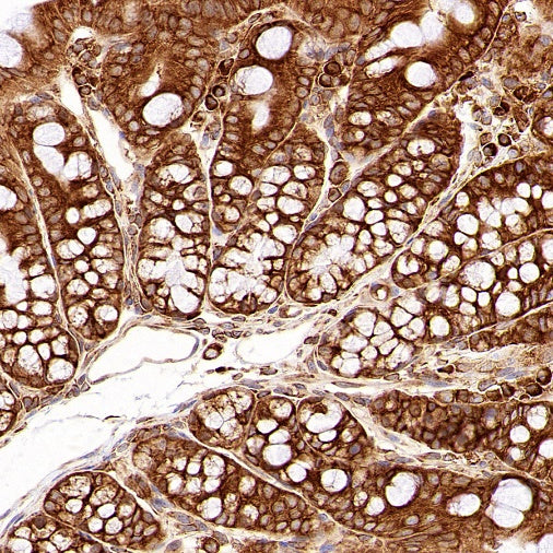PABP Recombinant Rabbit mAb (S-1744-42)