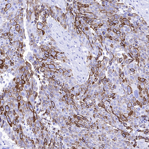 CK7/8 Recombinant Rabbit mAb (SDT-P006)