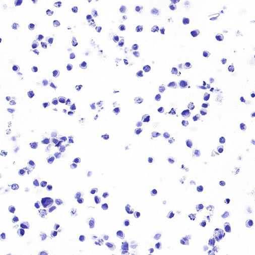 STEAP3 Recombinant Rabbit mAb (S-4466-26)