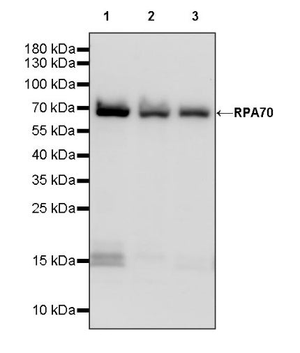 RPA70 Recombinant Rabbit mAb (S-1653-9)