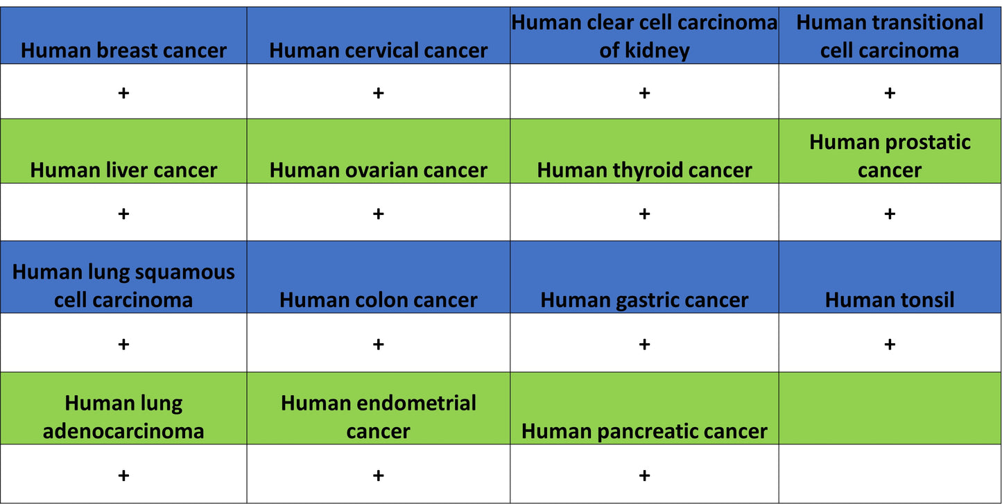 TREM2 Recombinant Rabbit mAb (S-5570)