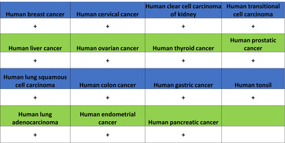 TREM2 Recombinant Rabbit mAb (S-5570)