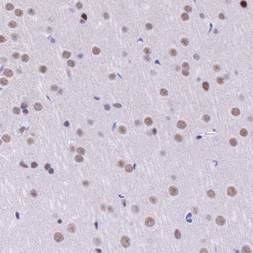 U2AF2 Recombinant Rabbit mAb (S-1324-1)
