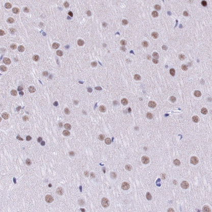 U2AF2 Recombinant Rabbit mAb (S-1324-1)